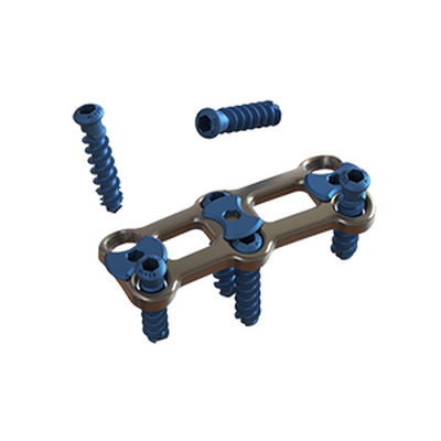 颈椎前路内固定系统（横向）